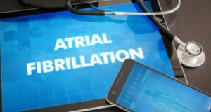 Atrial Fibrillation