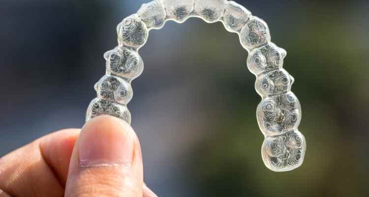 An Overview of the Invisalign Timeline