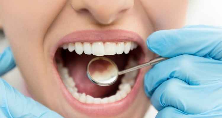 Can Orthodontists Do Fillings