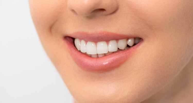 Teeth Whitening Techniques for a Magnificent Smile