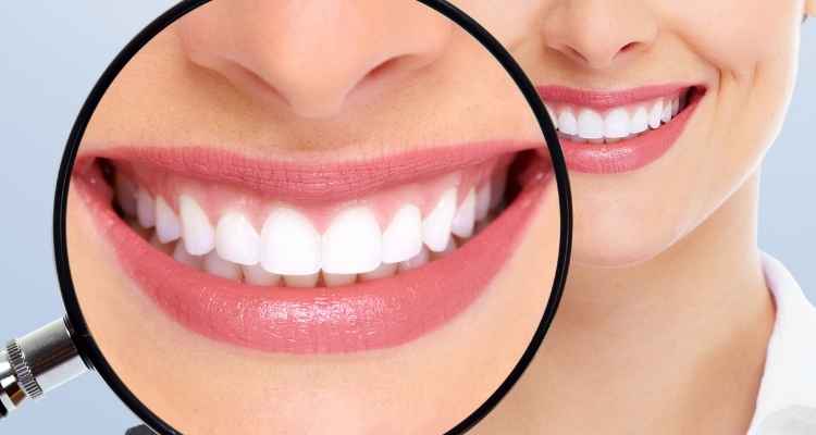 A Better Understanding of Teeth Whitening