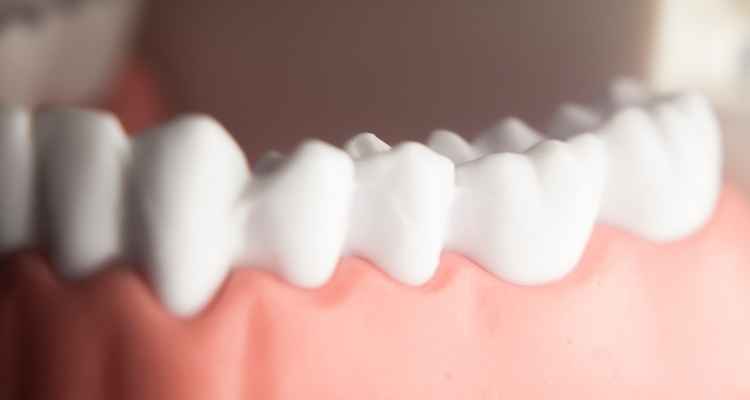 Cosmetic Dentistry for Teeth Repair