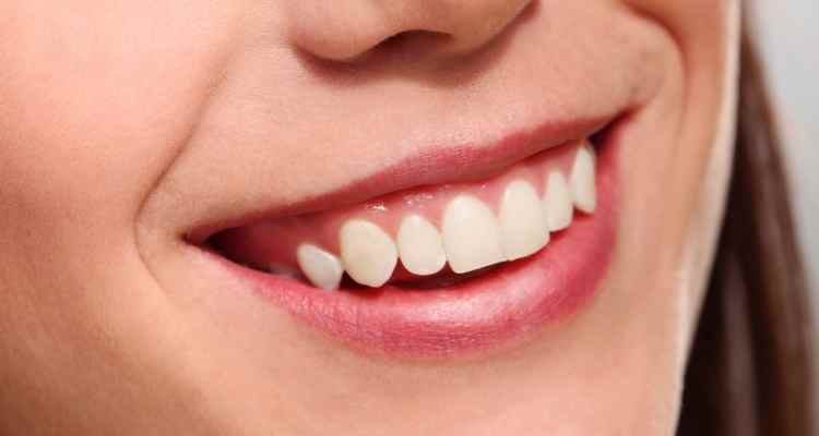 Upgrade Your Smile With Porcelain Veneers