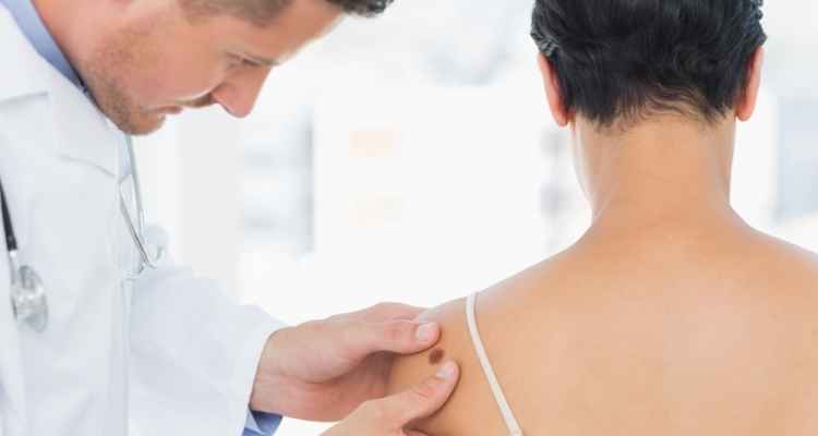 When to See Your Doctor for Melanoma