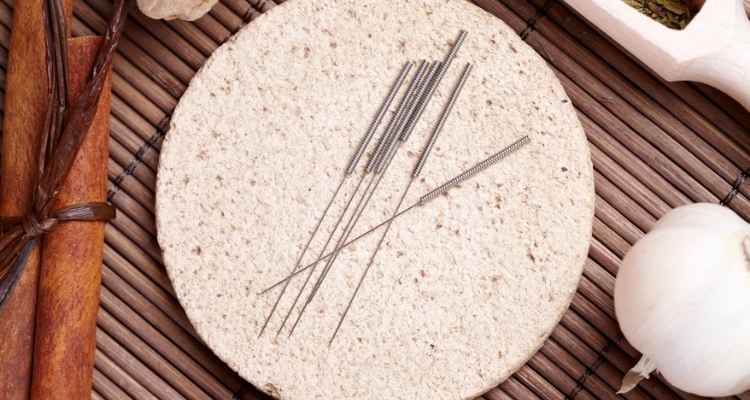 Are Acupuncture and Dry Needling the Same