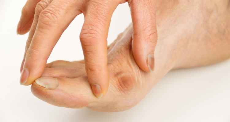 7 Easy Steps to Manage Bunion Pain