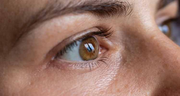 Keratoconus - Everything You Need to Know