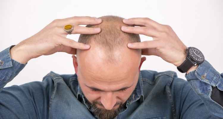 How Much Is Non-Surgical Hair Restoration