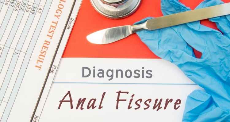 What Does Anal Fissure Look Like