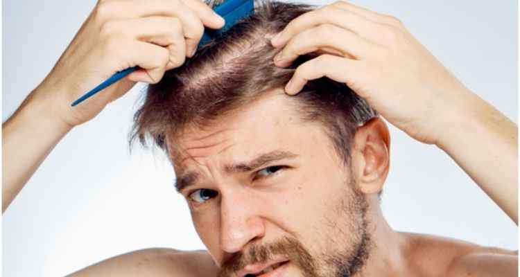 5 Hair Loss Solutions You Haven't Heard About