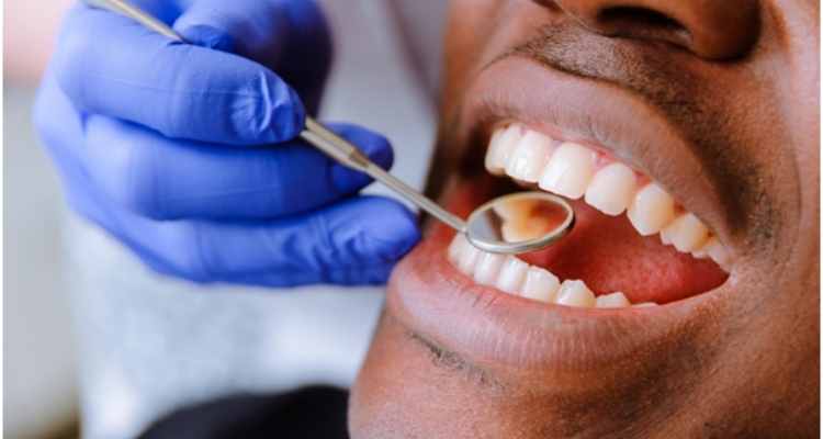 How Do Dentists Fix Broken Teeth?