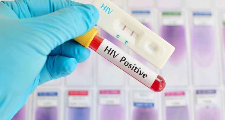 Lifestyle Habits To Avoid After Testing Positive For HIV