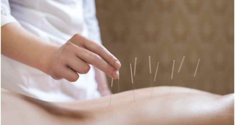 Traditional Chinese Medicine Practitioners: What You Should Know