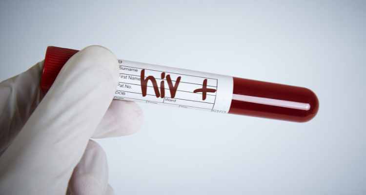 Where can I get HIV Screening in Singapore