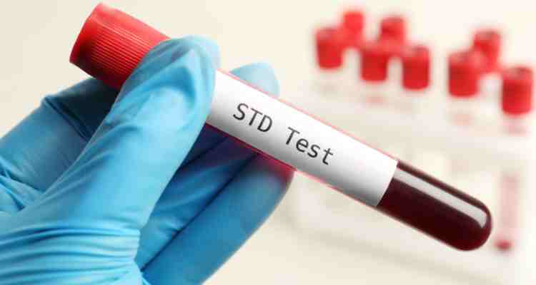 STD Testing Singapore Who should I see if I think I have STD