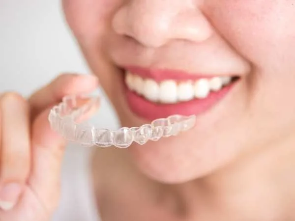 Invisalign Cost: How Much It Really Costs & Why